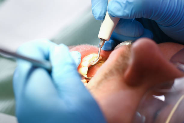 Best Emergency Tooth Extraction  in Middleport, OH