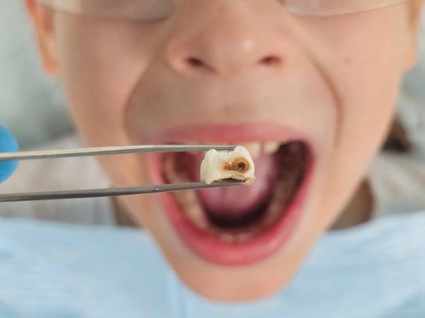 Best Emergency Dental Filling Replacement  in Middleport, OH